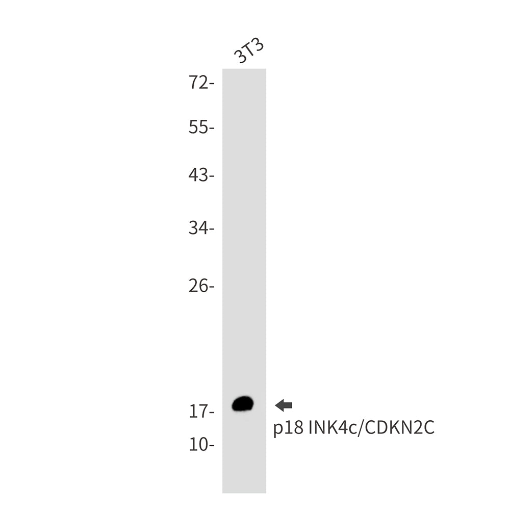 CDKN2C Rabbit Monoclonal Antibody