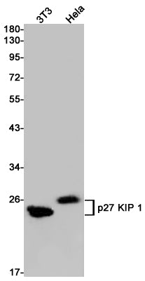 p27 Kip 1 Rabbit Monoclonal Antibody