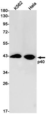 p40 Rabbit Monoclonal Antibody