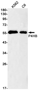 P4HB Rabbit Monoclonal Antibody