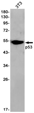 p53 Rabbit Monoclonal Antibody