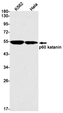 p60 Katanin Rabbit Monoclonal Antibody