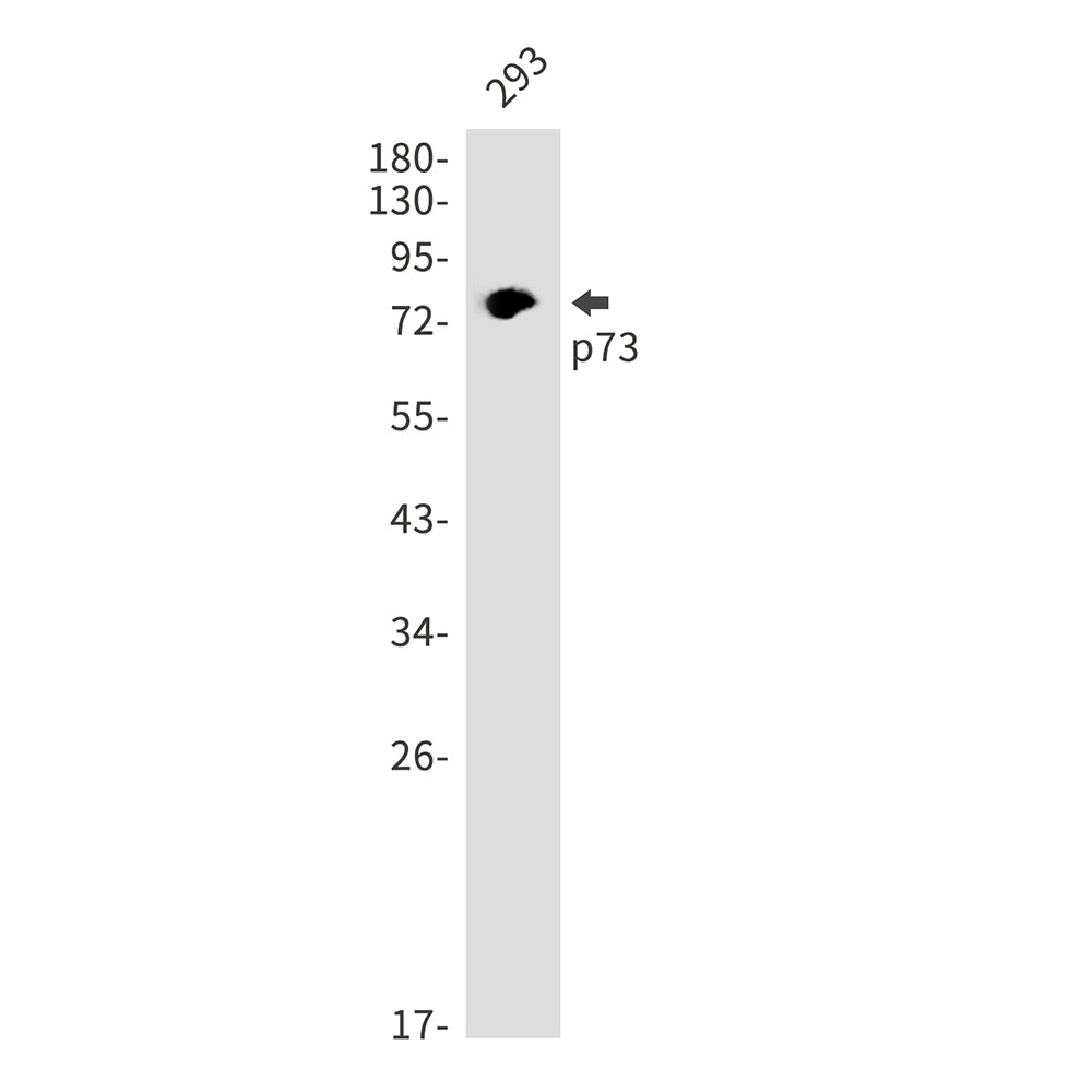 p73 Rabbit Monoclonal Antibody