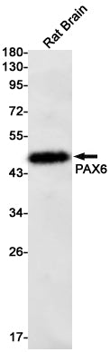 PAX6 Rabbit Monoclonal Antibody
