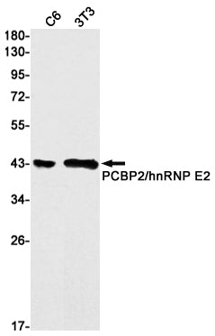 PCBP2 Rabbit Monoclonal Antibody