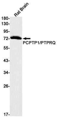 PCPTP1 Rabbit Monoclonal Antibody