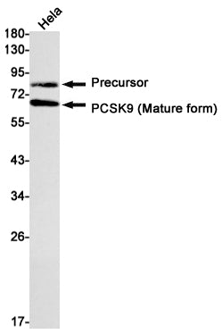 PCSK9 Rabbit Monoclonal Antibody
