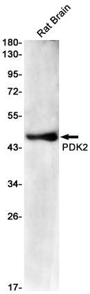 PDK2 Rabbit Monoclonal Antibody