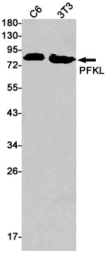 PFKL Rabbit Monoclonal Antibody