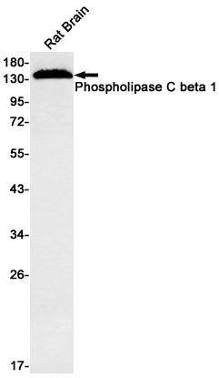 Phospholipase C beta 1 Rabbit Monoclonal Antibody