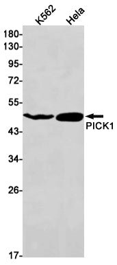 PICK1 Rabbit Monoclonal Antibody