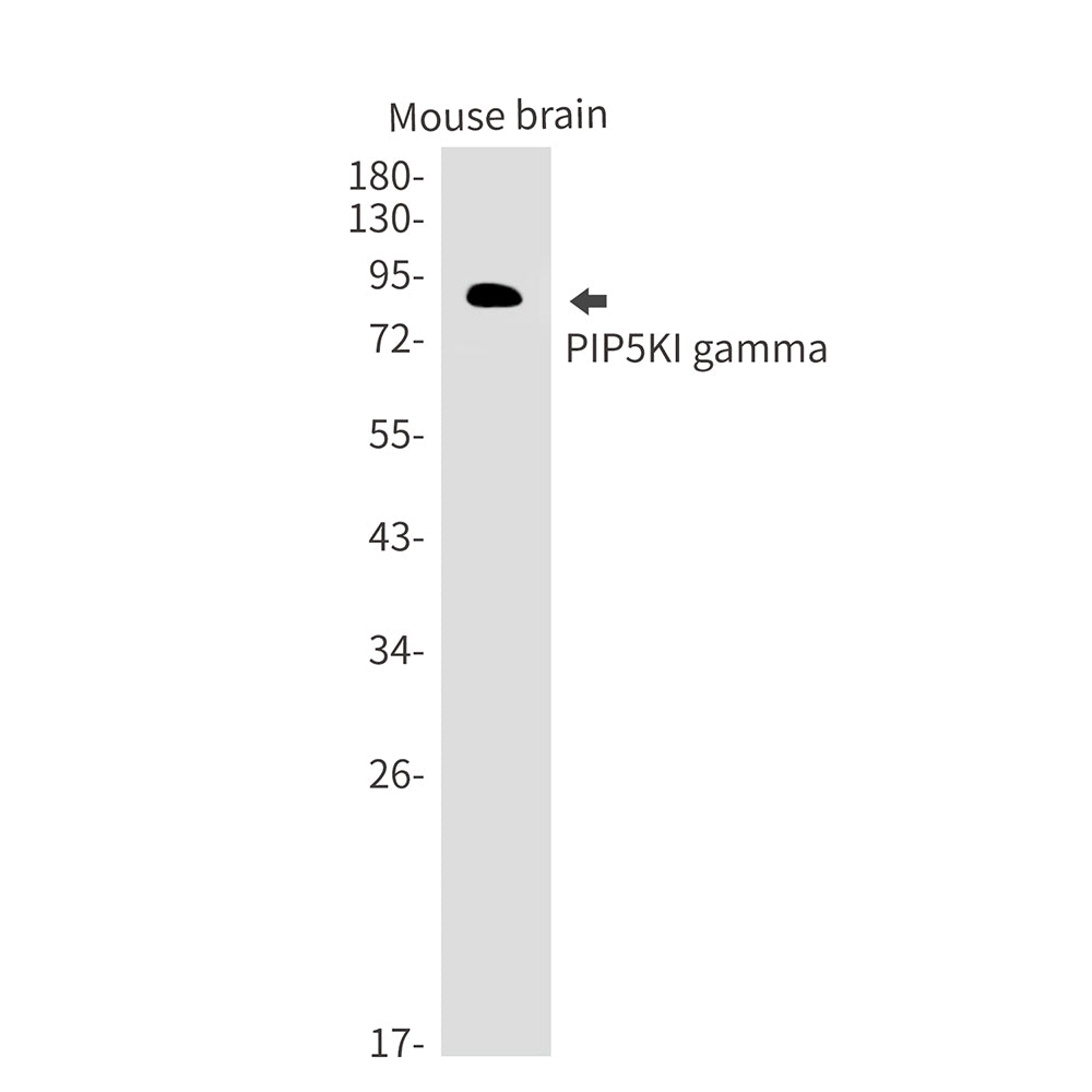 PIP5K1C Rabbit Monoclonal Antibody