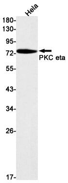 PKC eta Rabbit Monoclonal Antibody