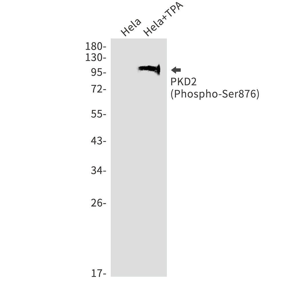 Phospho-PRKD2 (Ser876) Rabbit Monoclonal Antibody