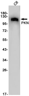 PKN1 Rabbit Monoclonal Antibody