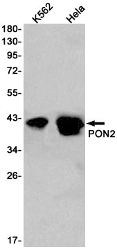PON2 Rabbit Monoclonal Antibody