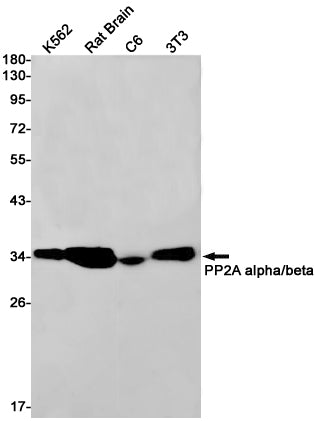 PP2A alpha/beta Rabbit Monoclonal Antibody