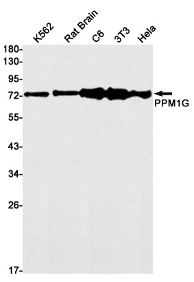 PPM1G Rabbit Monoclonal Antibody
