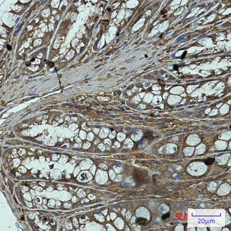 PP1C alpha/beta Rabbit Monoclonal Antibody