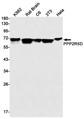 PPP2R5D Rabbit Monoclonal Antibody