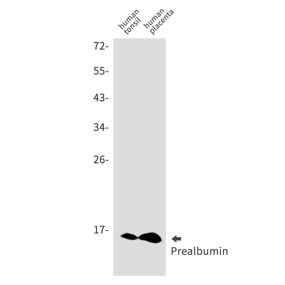 Prealbumin Rabbit Monoclonal Antibody