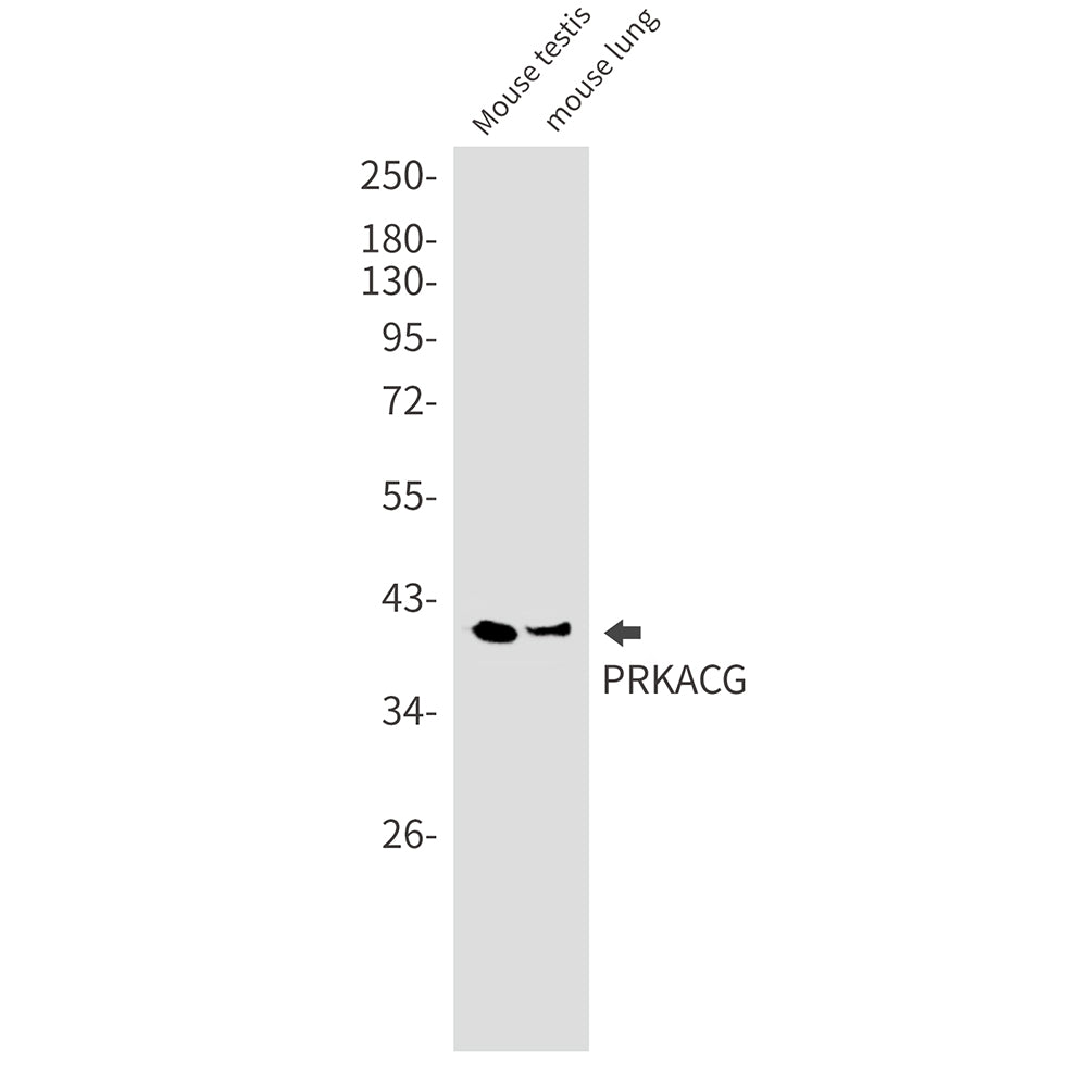 PKA C gamma Rabbit Monoclonal Antibody