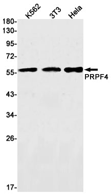PRPF4 Rabbit Monoclonal Antibody