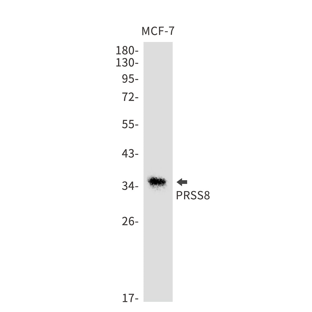 PRSS8 Rabbit Monoclonal Antibody