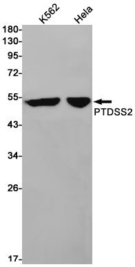 PSS2 Rabbit Monoclonal Antibody