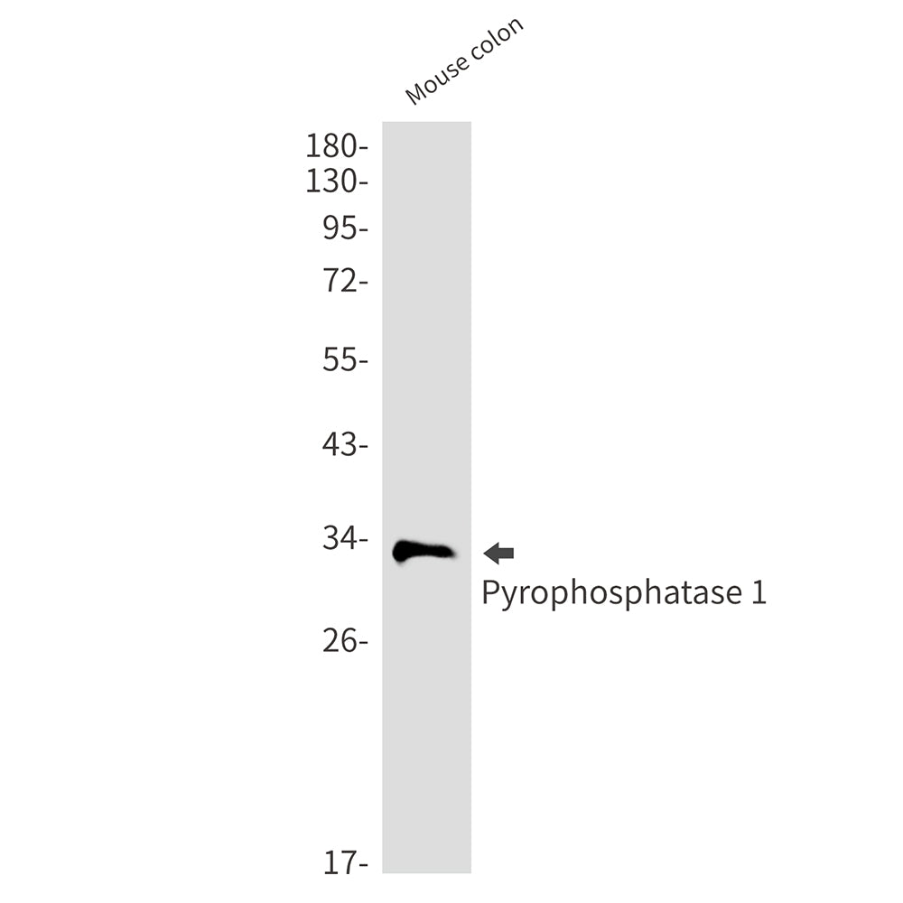 Pyrophosphatase 1 Rabbit Monoclonal Antibody