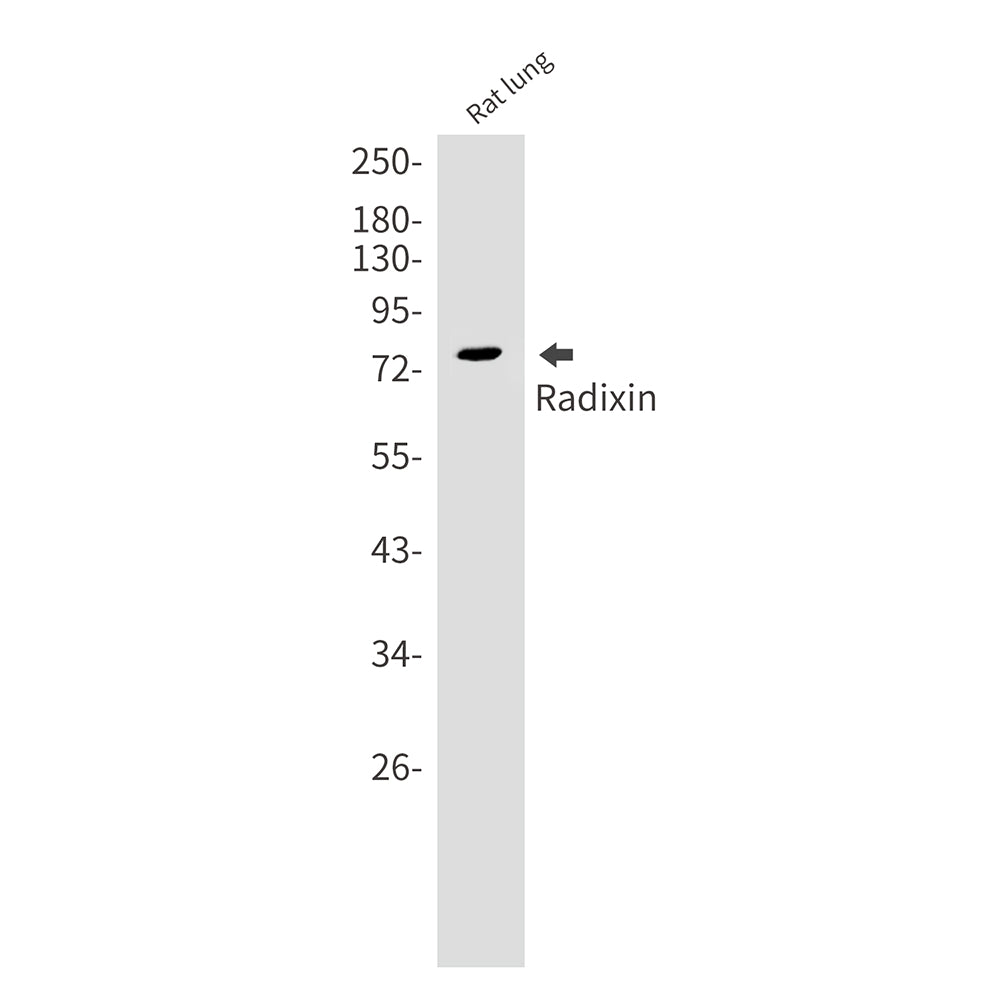 Radixin Rabbit Monoclonal Antibody