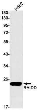 RAIDD Rabbit Monoclonal Antibody