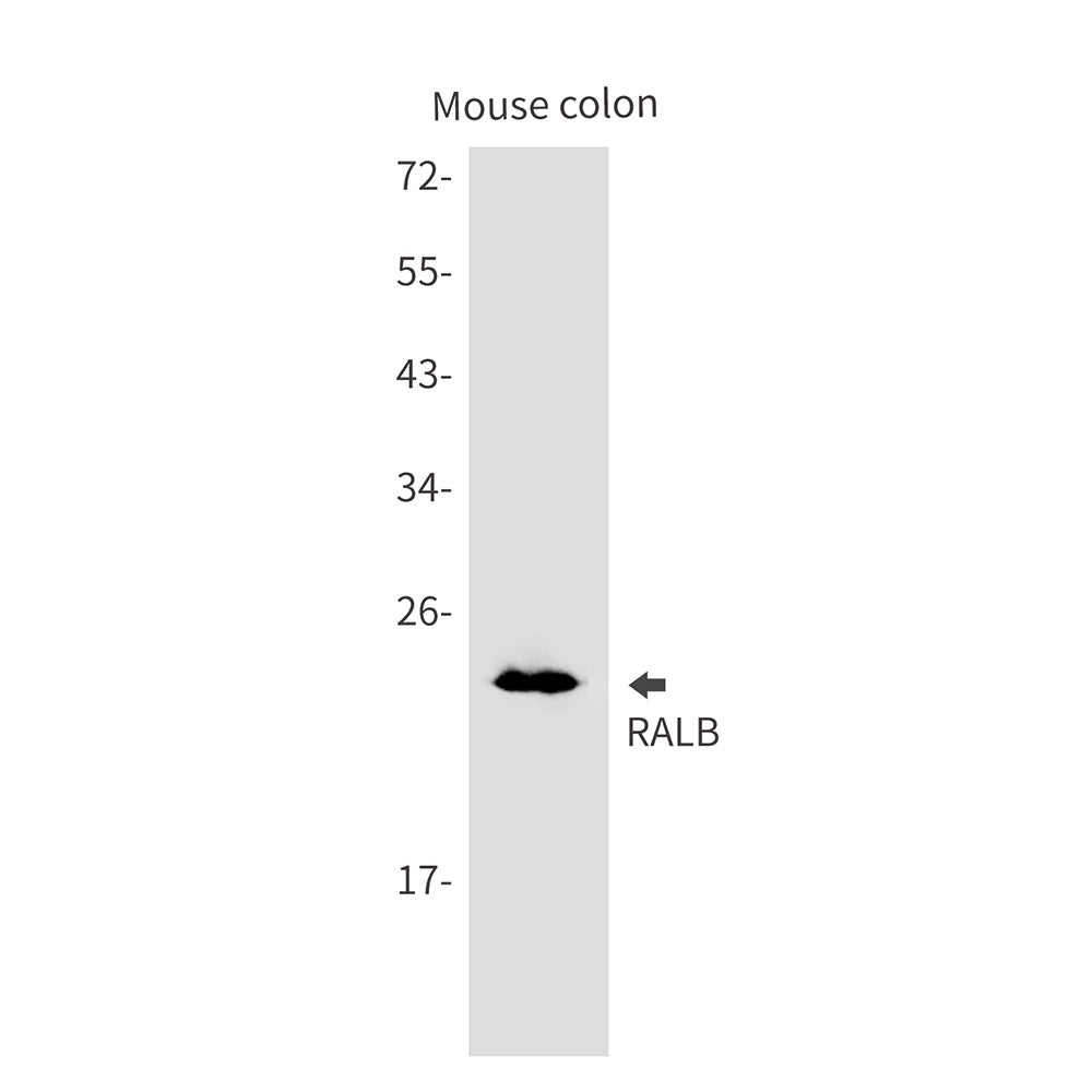 RALB Rabbit Monoclonal Antibody