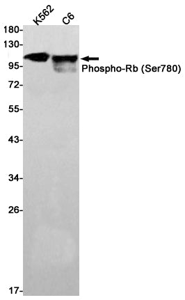 Phospho-Rb (Ser780) Rabbit Monoclonal Antibody
