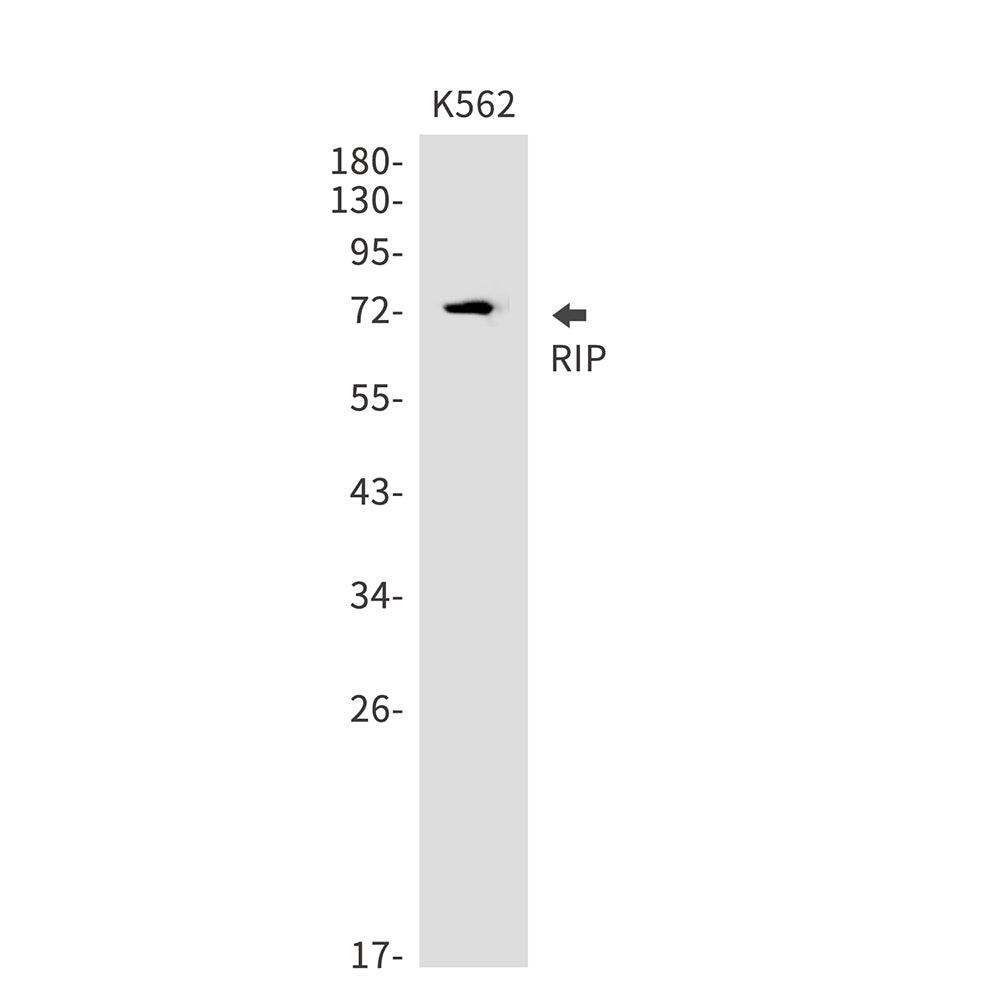 RIP Rabbit Monoclonal Antibody