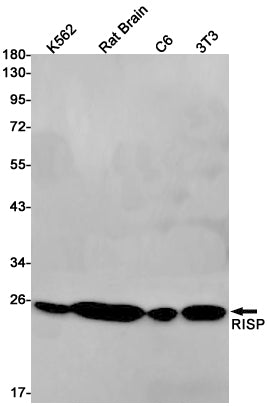Complex III Subunit 5 Rabbit Monoclonal Antibody