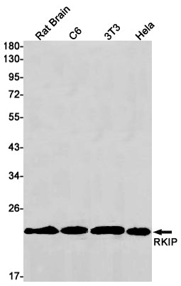 RKIP Rabbit Monoclonal Antibody