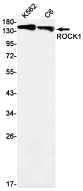 ROCK1 Rabbit Monoclonal Antibody