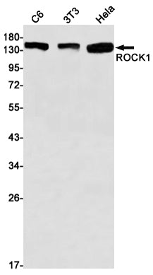 ROCK1 Rabbit Monoclonal Antibody
