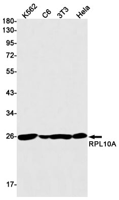 RPL10A Rabbit Monoclonal Antibody
