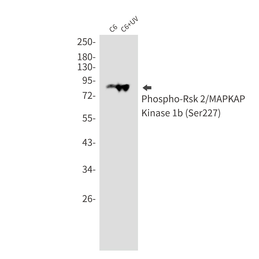 Phospho-RSK2 (Ser227) Rabbit Monoclonal Antibody