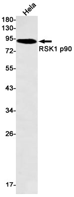 RSK1 p90 Rabbit Monoclonal Antibody