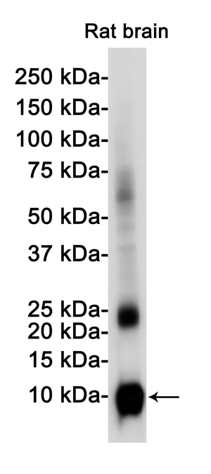 S100B Rabbit Monoclonal Antibody