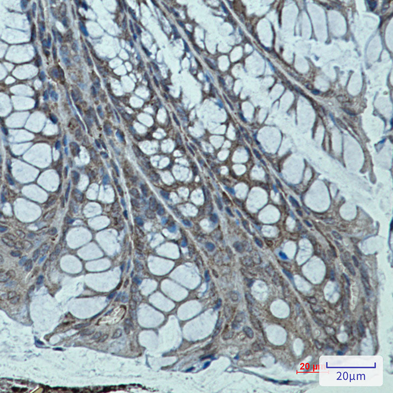 Sarcomeric alpha Actinin Rabbit Monoclonal Antibody