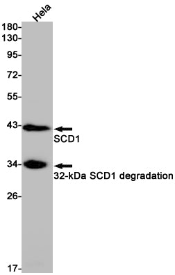 SCD1 Rabbit Monoclonal Antibody