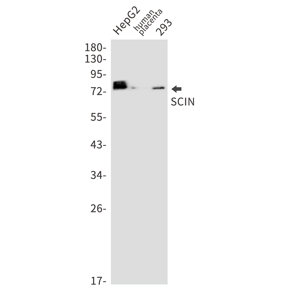 SCIN Rabbit Monoclonal Antibody