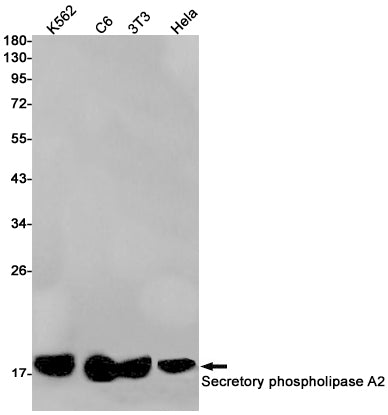 Secretory Phospholipase A2 Rabbit Monoclonal Antibody