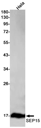 SEP15 Rabbit Monoclonal Antibody