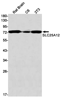 SLC25A12 Rabbit Monoclonal Antibody