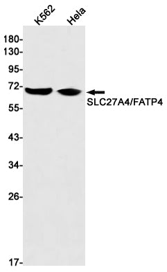 SLC27A4 Rabbit Monoclonal Antibody